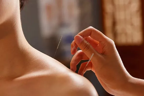 Traditional Chinese Medicine